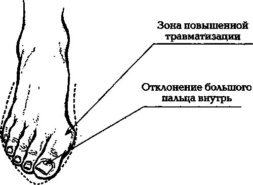 Павел Евдокименко - Артроз. Избавляемся от боли в суставах