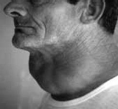 Леонид Рудницкий - Заболевания щитовидной железы: лечение и профилактика