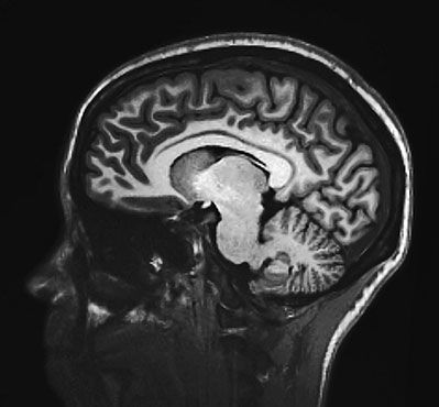 Себастьян Сеунг - Коннектом. Как мозг делает нас тем, что мы есть