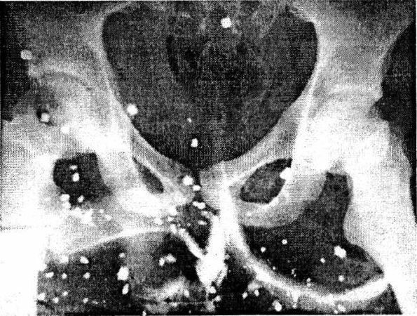 Александр Минченко - Раны. Лечение и профилактика осложнений. Учебное пособие