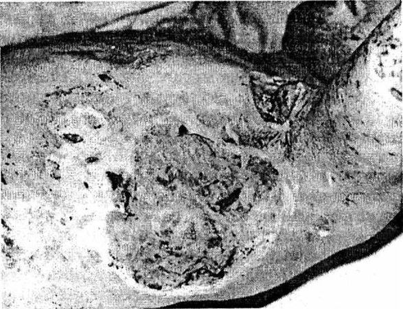 Александр Минченко - Раны. Лечение и профилактика осложнений. Учебное пособие