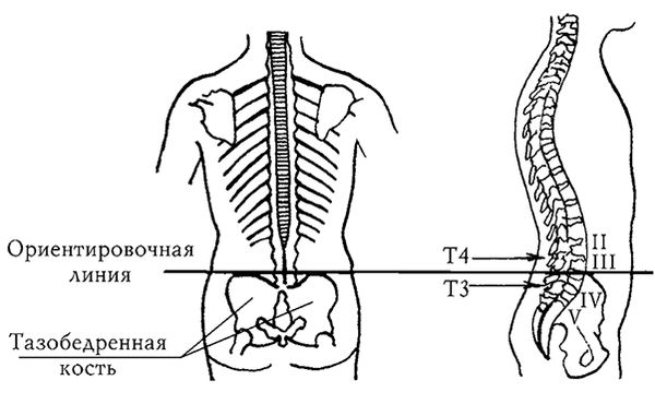 Ирина Калюжнова - Остеохондроз