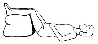 Ирина Калюжнова - Остеохондроз