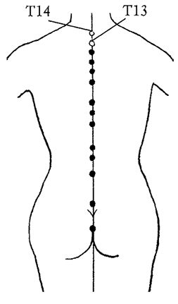 Ирина Калюжнова - Остеохондроз