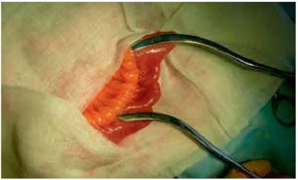 Владимир Мартынов, Коллектив авторов - СИБР (хирургическое лечение и профилактика)