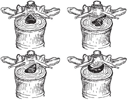 Виктор Ченцов - Первая скрипка позвоночника