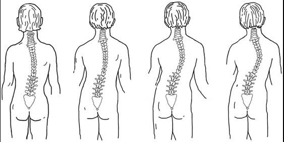 Виктор Ченцов - Первая скрипка позвоночника