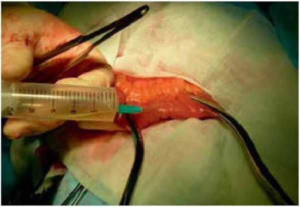 Владимир Мартынов, Коллектив авторов - СИБР (хирургическое лечение и профилактика)