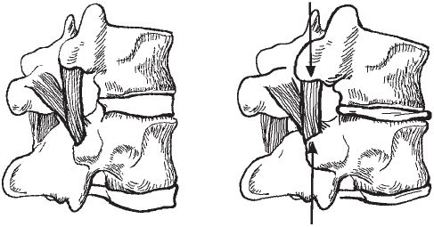 Виктор Ченцов - Первая скрипка позвоночника