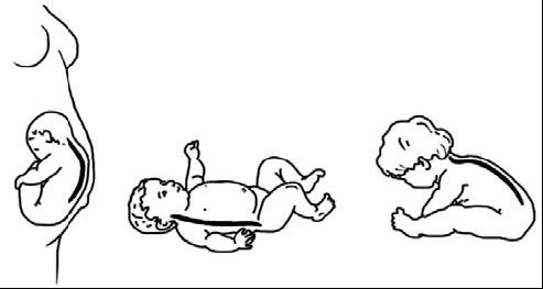 Виктор Ченцов - Первая скрипка позвоночника