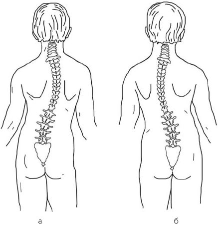 Виктор Ченцов - Первая скрипка позвоночника