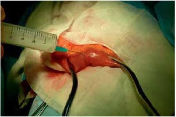 Владимир Мартынов, Коллектив авторов - СИБР (хирургическое лечение и профилактика)