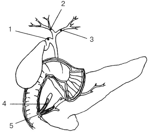 Светлана Чойжинимаева - Болезни сильных людей, или Как обуздать желчь?