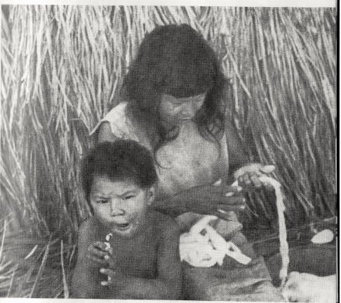 Игорь Фесуненко - Пост Леонардо