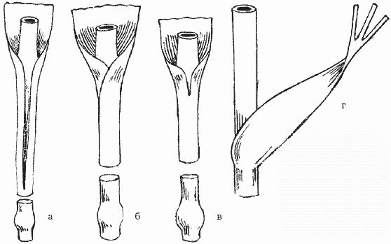 Ольга Шумахер, Оксана Петросян - Борьба с сорняками