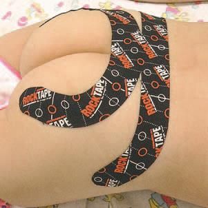 Дмитрий Киселев - Кинезиотейпинг в лечебной практике неврологии и ортопедии