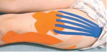 Дмитрий Киселев - Кинезиотейпинг в лечебной практике неврологии и ортопедии