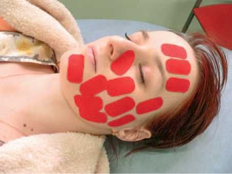 Дмитрий Киселев - Кинезиотейпинг в лечебной практике неврологии и ортопедии