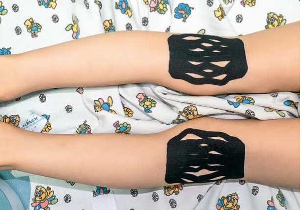 Дмитрий Киселев - Кинезиотейпинг в лечебной практике неврологии и ортопедии