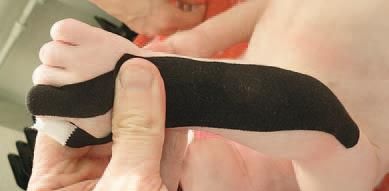 Дмитрий Киселев - Кинезиотейпинг в лечебной практике неврологии и ортопедии