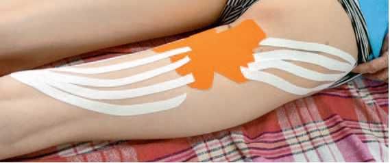 Дмитрий Киселев - Кинезиотейпинг в лечебной практике неврологии и ортопедии