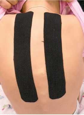 Дмитрий Киселев - Кинезиотейпинг в лечебной практике неврологии и ортопедии