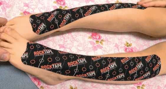 Дмитрий Киселев - Кинезиотейпинг в лечебной практике неврологии и ортопедии