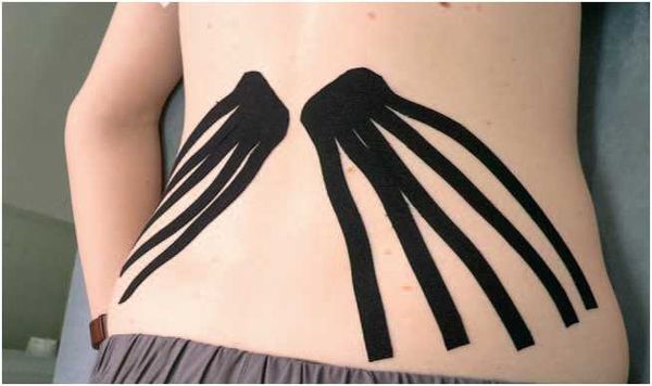 Дмитрий Киселев - Кинезиотейпинг в лечебной практике неврологии и ортопедии