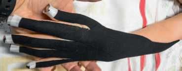 Кинезиотейпинг в лечебной практике...