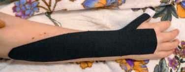 Кинезиотейпинг в лечебной практике...