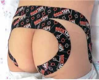 Дмитрий Киселев - Кинезиотейпинг в лечебной практике неврологии и ортопедии