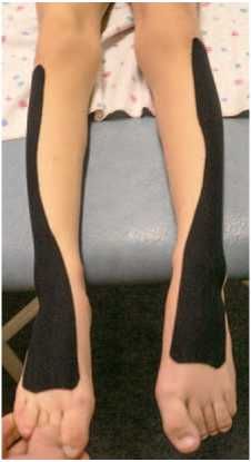 Дмитрий Киселев - Кинезиотейпинг в лечебной практике неврологии и ортопедии