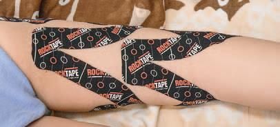 Дмитрий Киселев - Кинезиотейпинг в лечебной практике неврологии и ортопедии