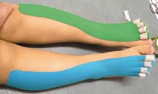 Дмитрий Киселев - Кинезиотейпинг в лечебной практике неврологии и ортопедии