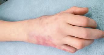 Дмитрий Киселев - Кинезиотейпинг в лечебной практике неврологии и ортопедии