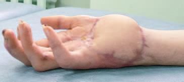 Дмитрий Киселев - Кинезиотейпинг в лечебной практике неврологии и ортопедии