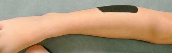 Дмитрий Киселев - Кинезиотейпинг в лечебной практике неврологии и ортопедии