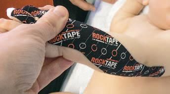 Дмитрий Киселев - Кинезиотейпинг в лечебной практике неврологии и ортопедии