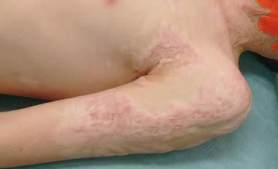 Дмитрий Киселев - Кинезиотейпинг в лечебной практике неврологии и ортопедии