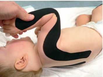 Дмитрий Киселев - Кинезиотейпинг в лечебной практике неврологии и ортопедии