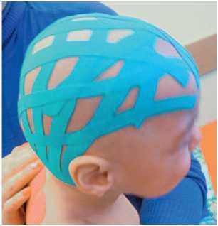 Дмитрий Киселев - Кинезиотейпинг в лечебной практике неврологии и ортопедии