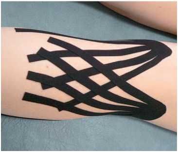 Дмитрий Киселев - Кинезиотейпинг в лечебной практике неврологии и ортопедии