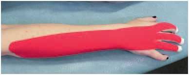 Дмитрий Киселев - Кинезиотейпинг в лечебной практике неврологии и ортопедии