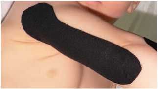 Дмитрий Киселев - Кинезиотейпинг в лечебной практике неврологии и ортопедии