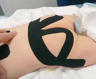 Дмитрий Киселев - Кинезиотейпинг в лечебной практике неврологии и ортопедии