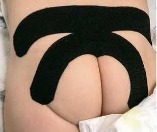 Дмитрий Киселев - Кинезиотейпинг в лечебной практике неврологии и ортопедии