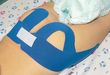 Дмитрий Киселев - Кинезиотейпинг в лечебной практике неврологии и ортопедии