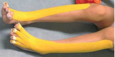 Дмитрий Киселев - Кинезиотейпинг в лечебной практике неврологии и ортопедии