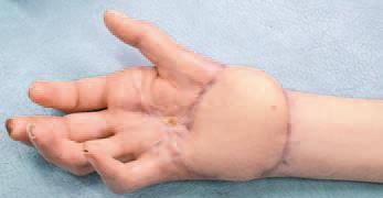 Дмитрий Киселев - Кинезиотейпинг в лечебной практике неврологии и ортопедии