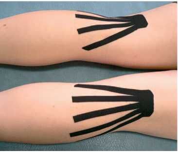 Дмитрий Киселев - Кинезиотейпинг в лечебной практике неврологии и ортопедии